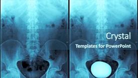 Presentation with exam - Colorful PPT layouts enhanced with urinary system - blue lower body exam backdrop and a ocean colored foreground