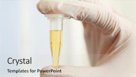  Presentation with urinary system - Slide deck having urinary system - doctor hand with test tube background and a lemonade colored foreground