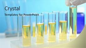  Presentation with test tubes - Slide deck with urinary system - doctor hand with test tubes background and a arctic colored foreground