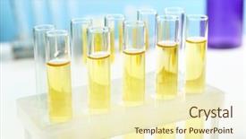  Presentation with urinary system - Beautiful PPT layouts featuring urinary system - test tubes in laboratory closeup backdrop and a cream colored foreground