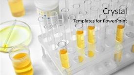 Presentation with urinary system - Slide deck with urinary system - test tubes in laboratory closeup background and a light gray colored foreground