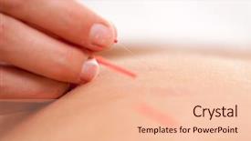  Presentation with bladder - Slide deck enhanced with urinury bladder - macro detail of a hand background and a lemonade colored foreground