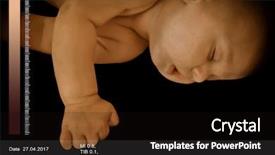  Presentation with uterus - Colorful presentation theme enhanced with uterus - 3d ultrasound scan of baby backdrop and a wine colored foreground