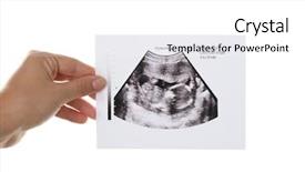  Presentation with uterus - Presentation design enhanced with uterus - female hand with ultrasound picture background and a white colored foreground
