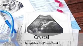  Presentation with baby ultrasound - Audience pleasing presentation theme consisting of uterus - ultrasound scan of baby backdrop and a light gray colored foreground