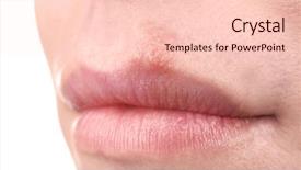  Presentation with viral - Slide set having viral infection - herpes blisters on female lips background and a lemonade colored foreground