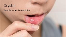  Presentation with disease - Presentation theme with oral disease - close up of woman background and a coral colored foreground