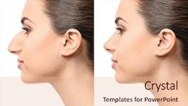  Presentation with rhinoplasty - Colorful presentation enhanced with white background plastic surgery backdrop and a lemonade colored foreground