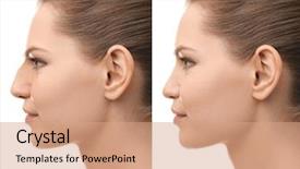  Presentation with rhinoplasty - Audience pleasing presentation design consisting of white background plastic surgery backdrop and a coral colored foreground