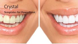  Presentation with dental - PPT layouts having whitening dental care healthy woman background and a coral colored foreground