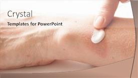  Presentation with scars - Presentation design with woman applying scars removal cream to heal the first degree - heat burn wound on her hand background and a sky blue colored foreground