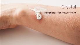  Presentation with scars - Colorful presentation theme enhanced with woman applying scars removal cream to heal the first degree - heat burn wound on her hand backdrop and a lemonade colored foreground