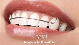  Presentation with orthodontic - Audience pleasing slides consisting of woman-beautiful-teeth-with-retainer backdrop and a coral colored foreground