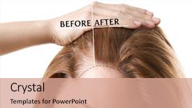  Presentation with loss - Colorful slide set enhanced with woman before and after hair backdrop and a coral colored foreground