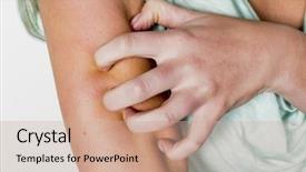  Presentation with skin - Colorful theme enhanced with woman itchy skin backdrop and a coral colored foreground