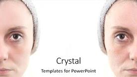  Presentation with deep - PPT layouts having woman with spotty skin with deep pores and blackhead and healed soft skin background and a pink colored foreground