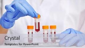  Presentation with laboratory blood test tubes - Colorful PPT theme enhanced with woman working with blood samples backdrop and a light gray colored foreground