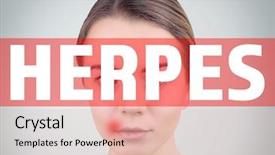  Presentation with herpes virus - Slide deck enhanced with virus dermatology - word herpes and woman background and a lemonade colored foreground
