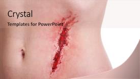  Presentation with blood - Colorful presentation theme enhanced with wound - injured abdomen with blood isolated backdrop and a coral colored foreground