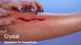  Presentation with blood - Slide deck having wound - injured leg with blood background and a tawny brown colored foreground