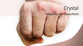  Presentation with injury - Colorful presentation theme enhanced with wound - skin abrasion injury backdrop and a lemonade colored foreground