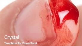  Presentation with wound care - Cool new PPT theme with wound care - bleeding from the cut finger backdrop and a coral colored foreground