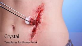  Presentation with wound care - Theme enhanced with wound care - injured abdomen with blood background and a coral colored foreground