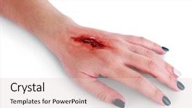  Presentation with blood - Colorful presentation theme enhanced with wound care - injured hand with blood isolated backdrop and a lemonade colored foreground