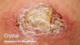  Presentation with makeup - Beautiful presentation featuring wound covered with antibacterial gel backdrop and a coral colored foreground