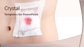  Presentation with infection - Amazing presentation theme having wound infection - injured abdomen with adhesive bandage backdrop and a lemonade colored foreground