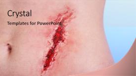  Presentation with blood - Slides enhanced with wound infection - injured abdomen with blood background and a lemonade colored foreground