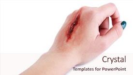  Presentation with blood - Theme featuring wound infection - injured hand with blood isolated background and a lemonade colored foreground