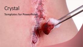  Presentation with blood - Theme with wound infection - injured abdomen with blood isolated background and a coral colored foreground