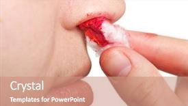  Presentation with wound care - Beautiful presentation featuring wound nosebleed - adult human nose backdrop and a coral colored foreground