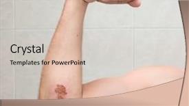  Presentation with wound care - Beautiful presentation theme featuring wounded elbow 3 the wound backdrop and a lemonade colored foreground