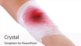  Presentation with wounded - Slide deck with wounded hand with bandage isolated background and a white colored foreground