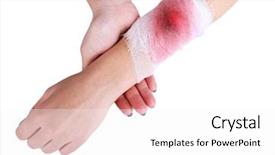  Presentation with wounded - Amazing PPT theme having wounded hand with bandage isolated backdrop and a white colored foreground