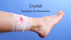  Presentation with wound - PPT layouts featuring wounded leg with bandage background and a light blue colored foreground