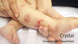  Presentation with wound - Cool new presentation theme with wounds on child's legs backdrop and a coral colored foreground