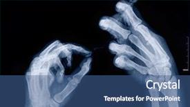  Presentation with xray - Beautiful presentation theme featuring wrist hand surgery - xray image of human arms backdrop and a ocean colored foreground