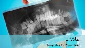  Presentation with xray - PPT theme consisting of x ray dental - female doctor with jaw xray background and a light blue colored foreground