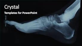  Presentation with human foot - PPT theme consisting of x-ray film background and a black colored foreground