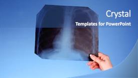  Presentation with chest - Audience pleasing PPT layouts consisting of x-ray image of chest backdrop and a ocean colored foreground