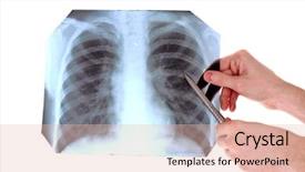  Presentation with chest - Presentation design enhanced with x-ray image of chest background and a lemonade colored foreground