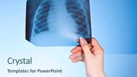  Presentation with chest - PPT layouts featuring x-ray image of chest background and a sky blue colored foreground