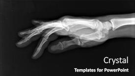  Presentation with black hand - Slide deck featuring x-ray image of human hand human hand x-ray isolated on black background and a black colored foreground