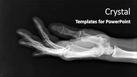 Presentation with black hand - Cool new theme with x-ray image of human hand human hand x-ray isolated on black backdrop and a black colored foreground