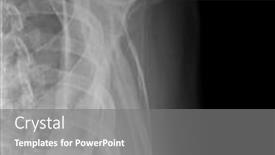  Presentation with human ribs - PPT layouts having x-ray image of human scapula ribs shoulder and bones x-ray isolated on black medical and science background and a gray colored foreground