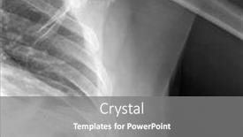  Presentation with human ribs - Audience pleasing slide deck consisting of x-ray image of human scapula ribs shoulder and bones x-ray isolated on black medical and science backdrop and a gray colored foreground