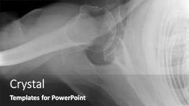  Presentation with human ribs - Beautiful slide deck featuring x-ray image of human shoulder ribs scapula and joints isolated on black medical and science technology backdrop and a dark gray colored foreground